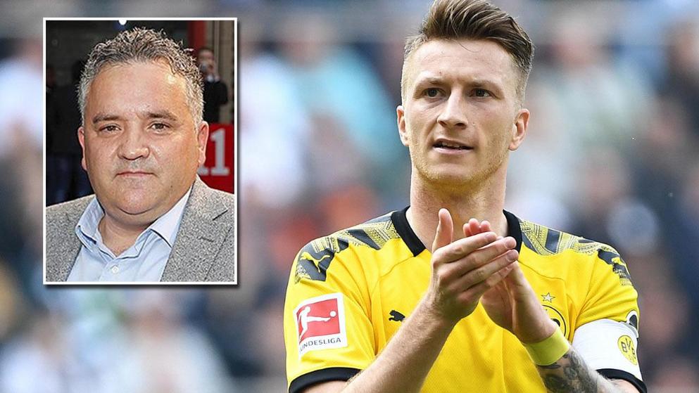 推杆不断扩 推杆不断扩